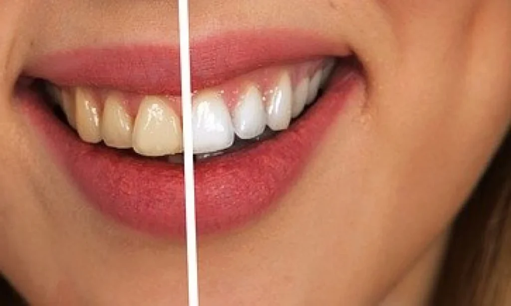 Bicarbonato Denti2