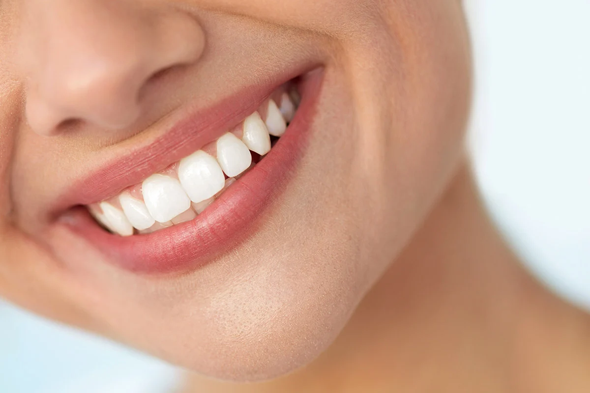 Denti Estetici