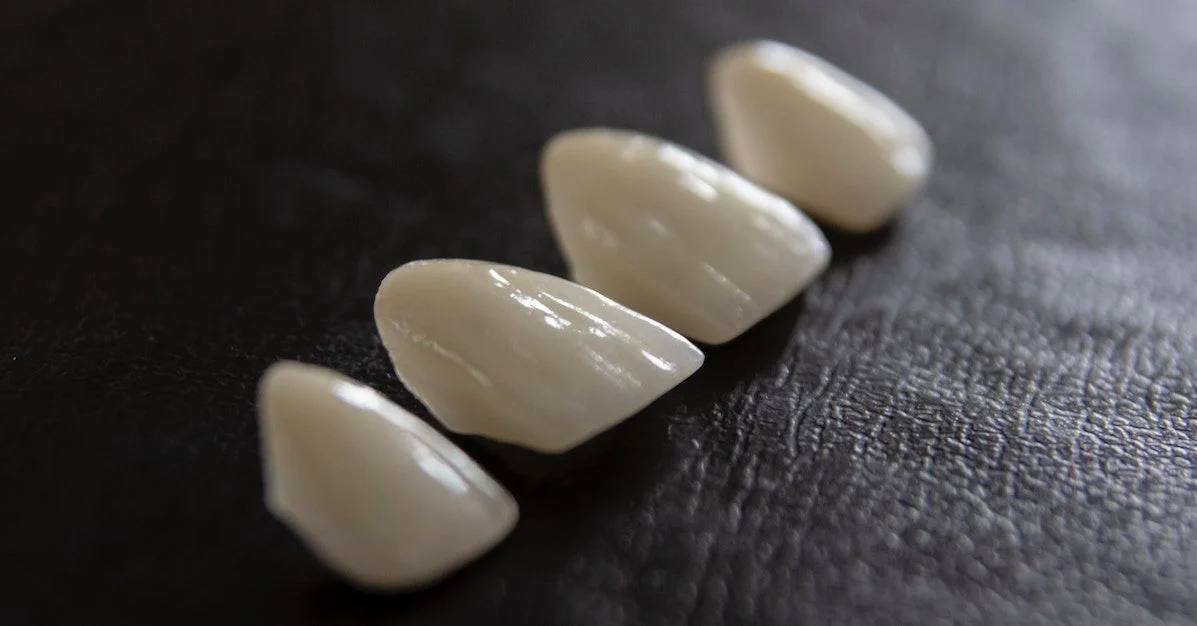 Denti in composito o ceramica4