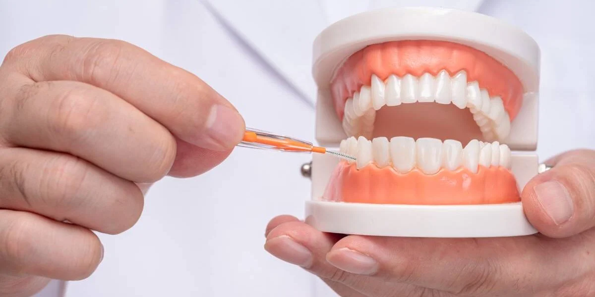 Ricostruzione Dente in Composito Durata3