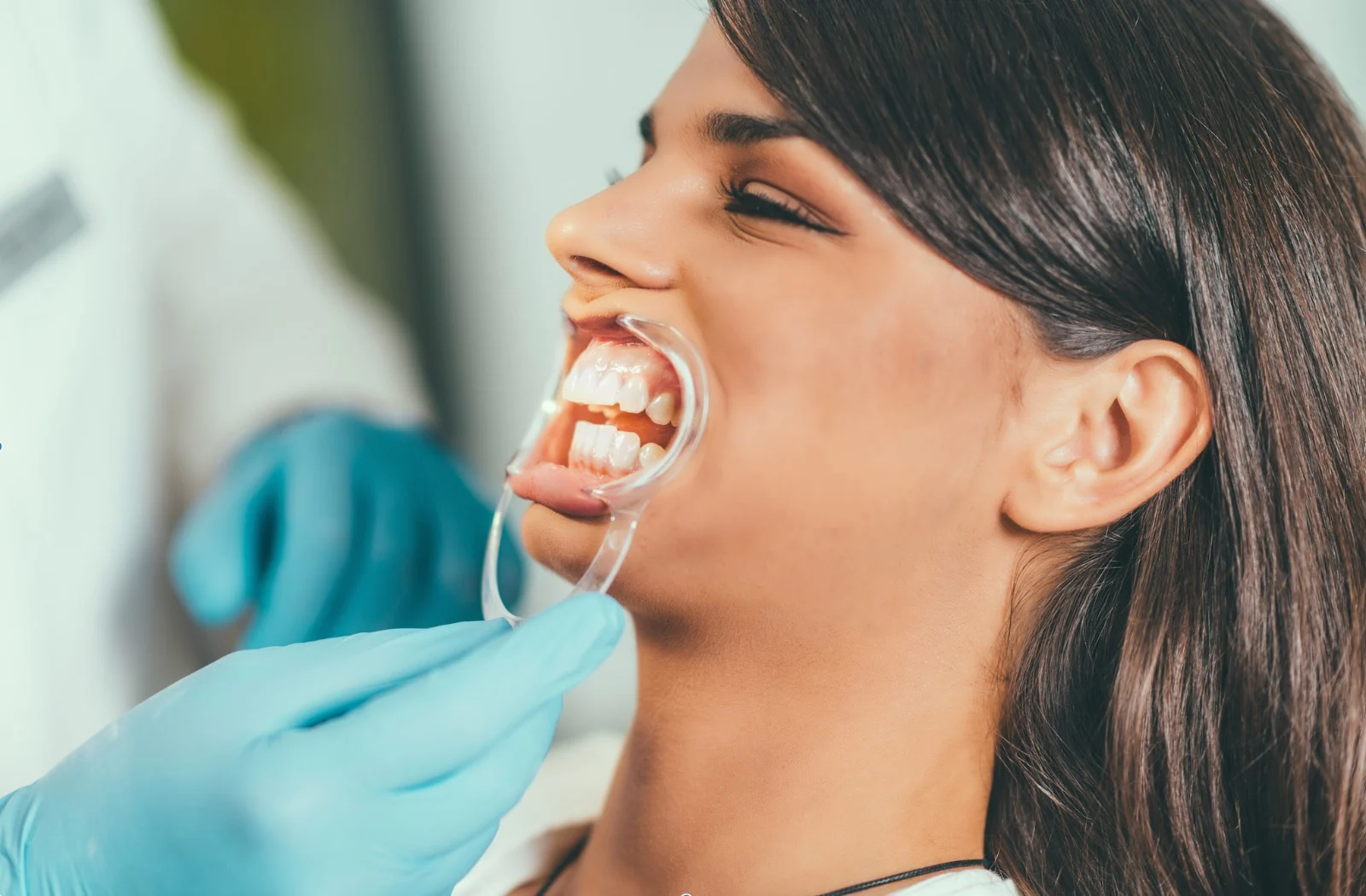 Sbiancante Denti Efficace1