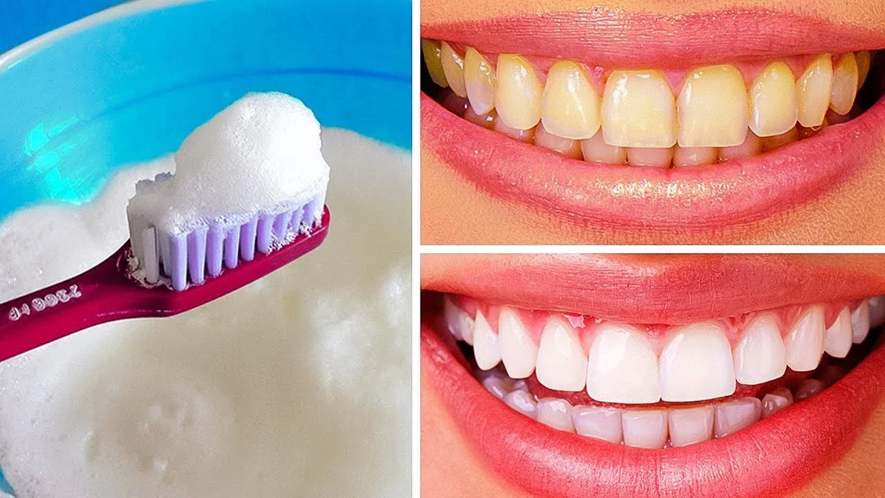 Sbiancare I Denti1 Come Sbiancare I Denti: Metodi Efficaci Per Un Sorriso Luminoso