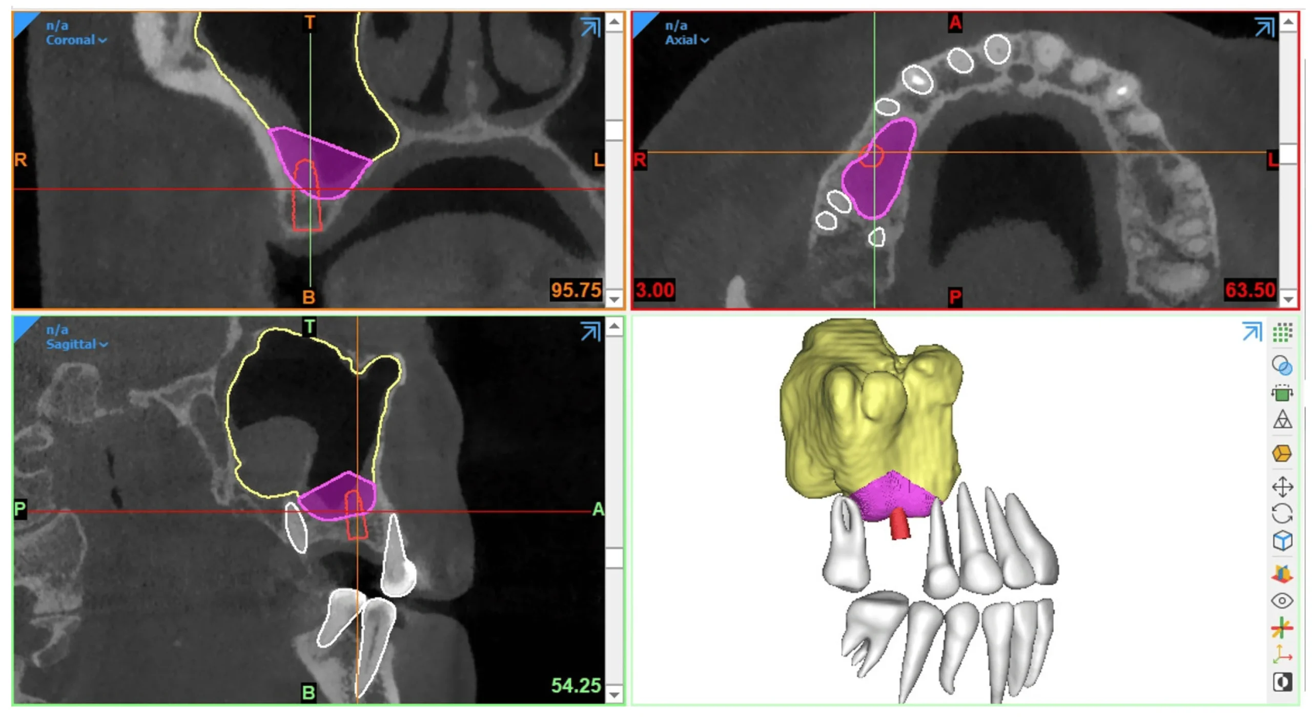 CBCT diagnoze planning2 scaled