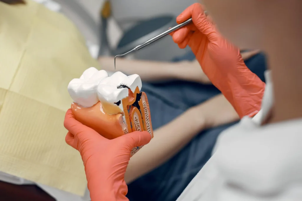 ROOT CANALS THERAPY