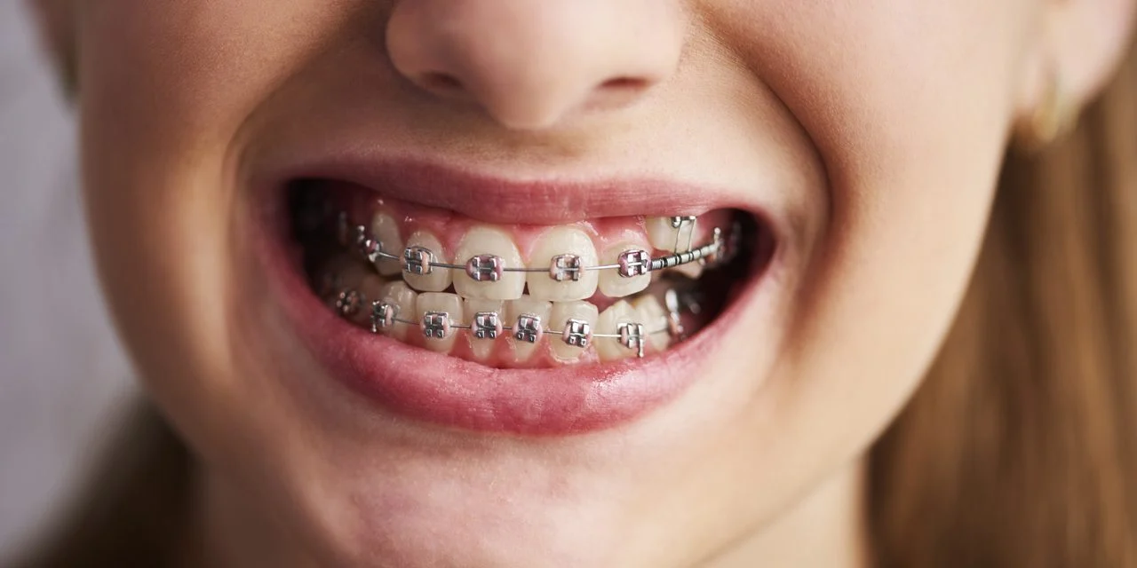 Sherbime Dentistrie Kozmetike1