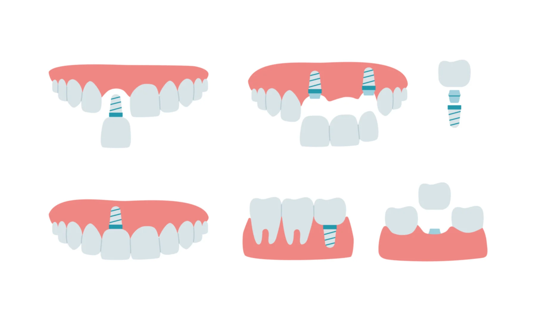 URAT DENTARE 1