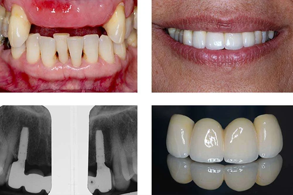 URAT DENTARE1 1