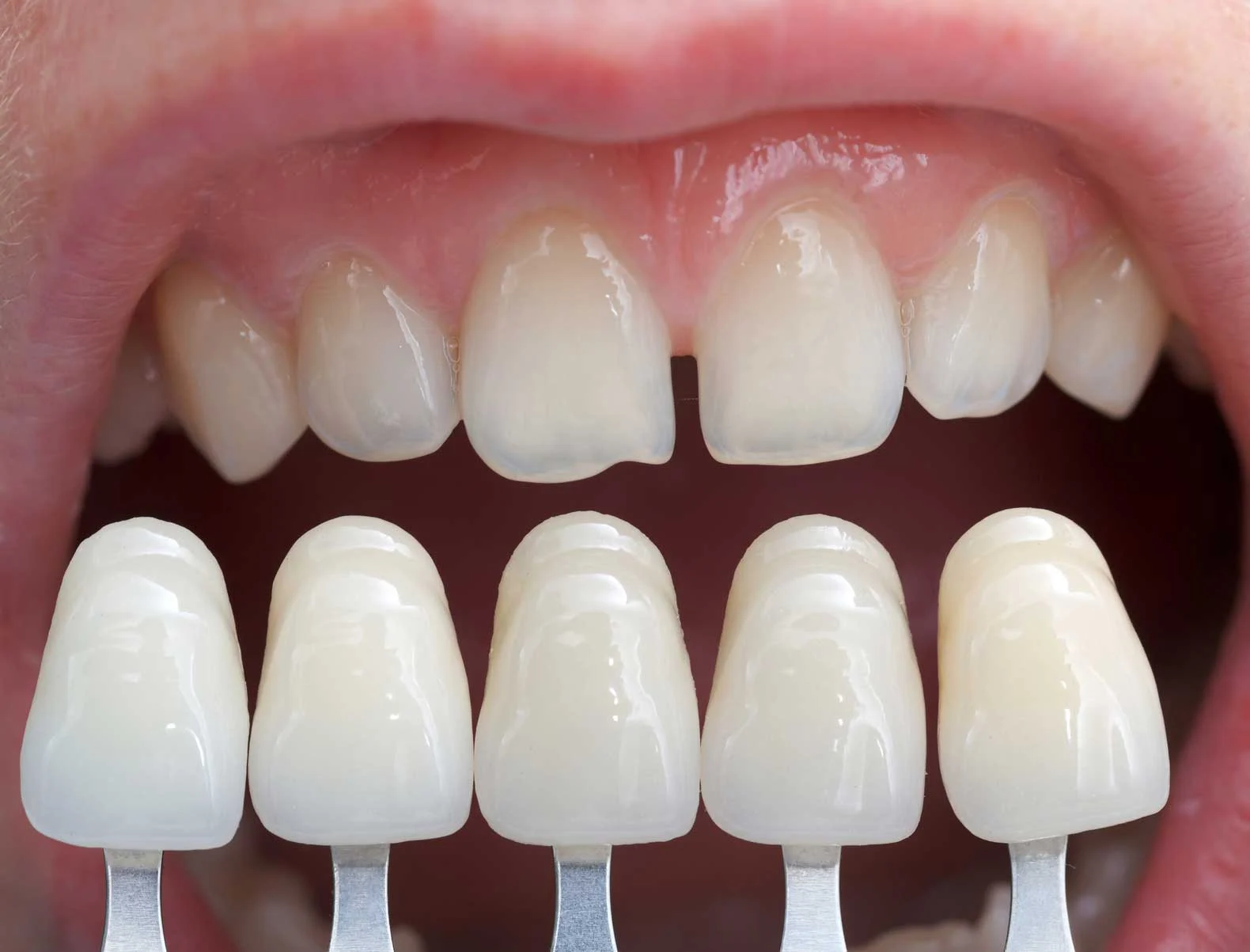 dentista estetico1