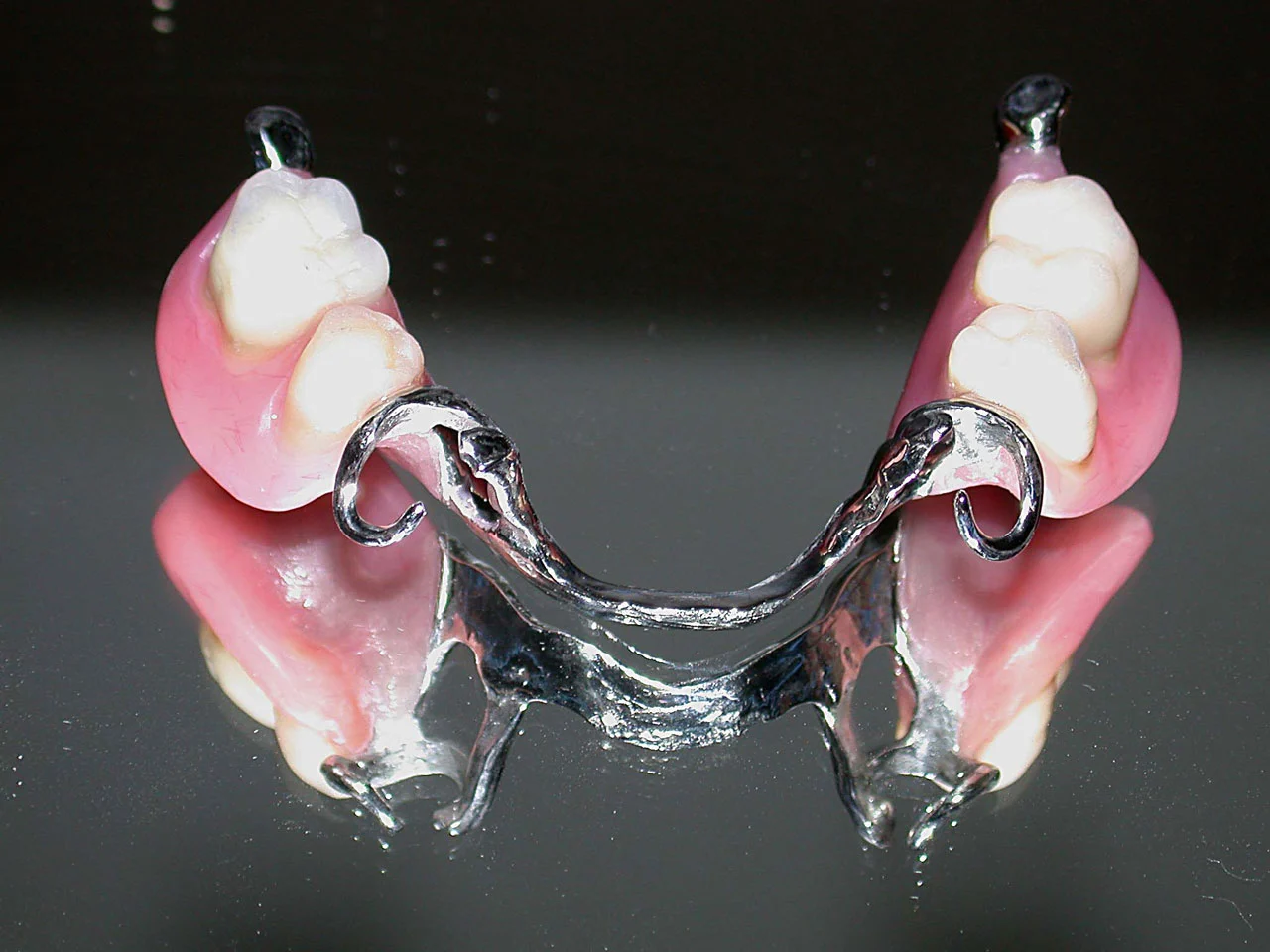 protesi per denti4 Dentiere Mobili di Ultima Generazione: Innovazioni, Tipologie e Prezzi