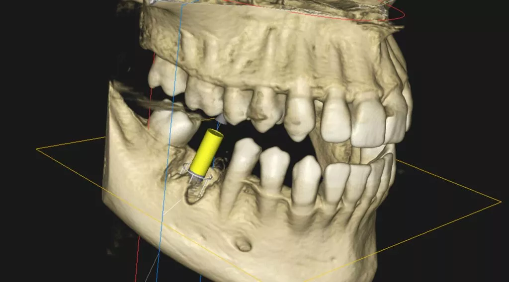 CBCT Scan Dental 1