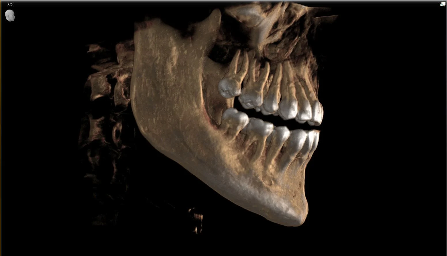 CBCT Scan Dental1