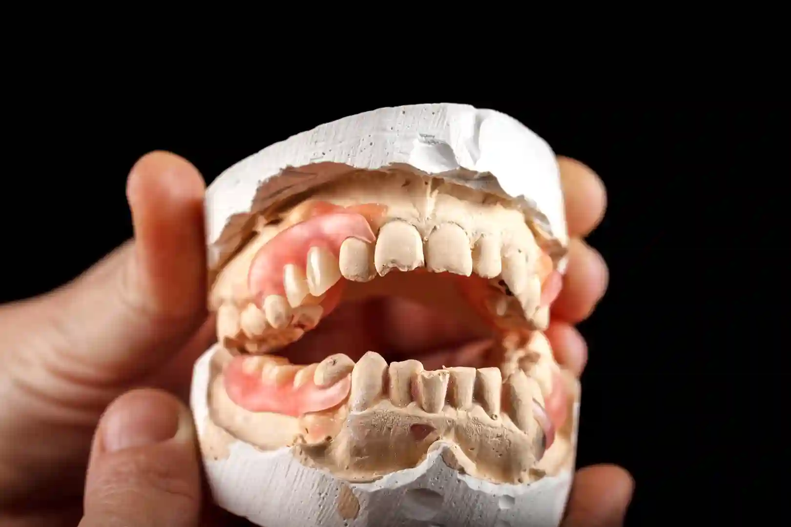Dentiere
