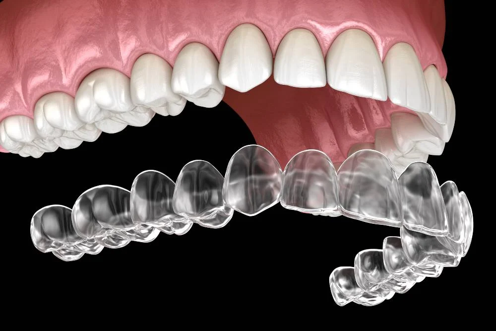 INVISALIGN.1
