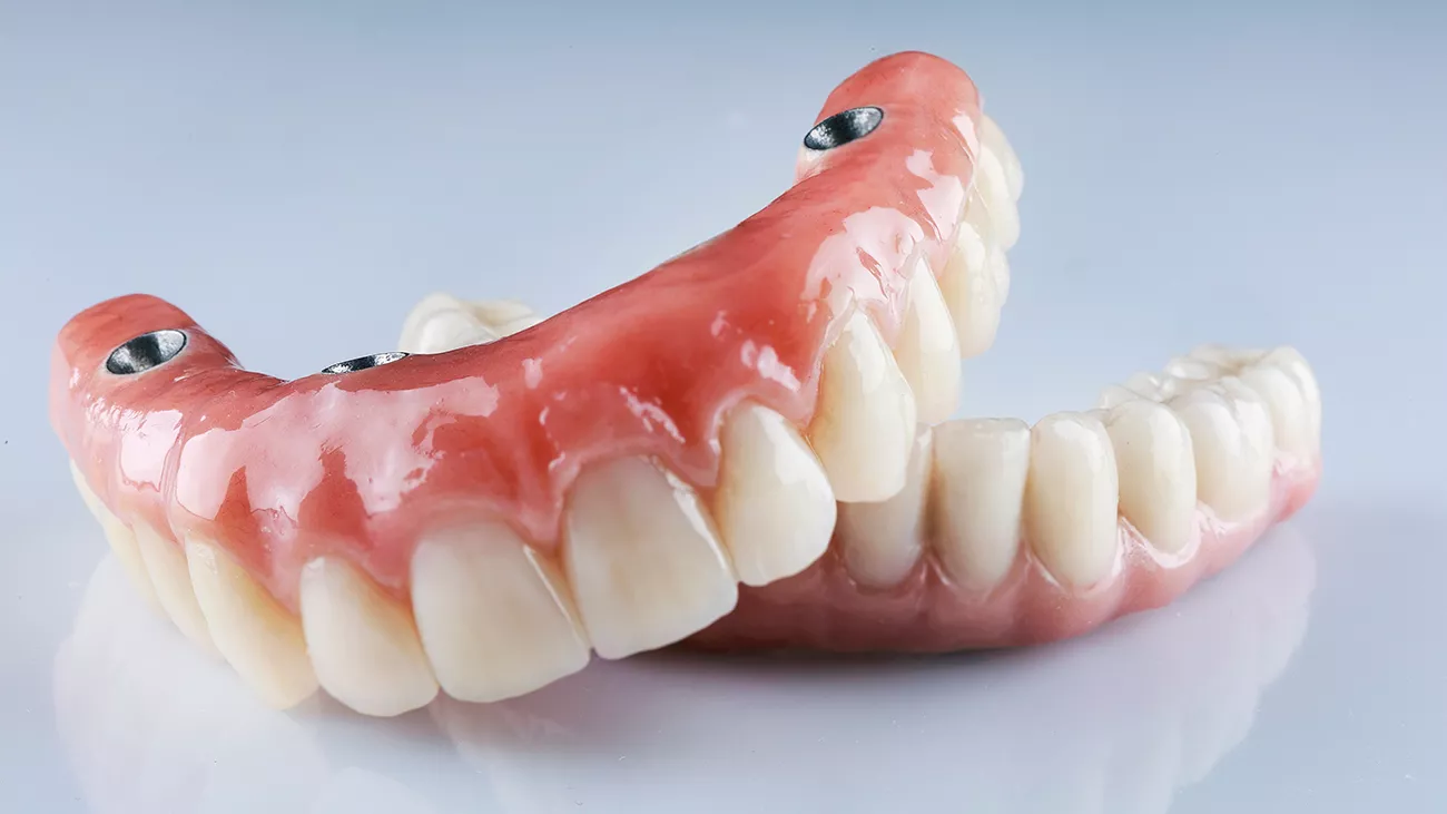 Odontoiatria estetica.2
