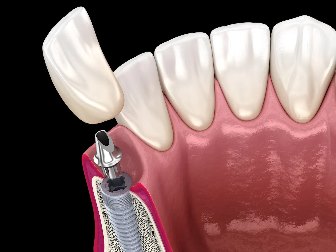Oral Surgery2