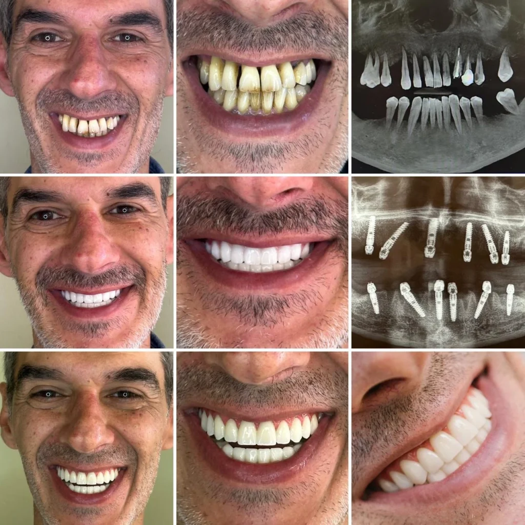 WhatsApp Image 2025 10 30 at 6.03.43 PM Dental Tourism Albania