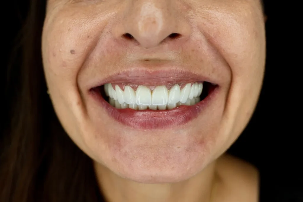 dental tourims Dental Tourism Albania