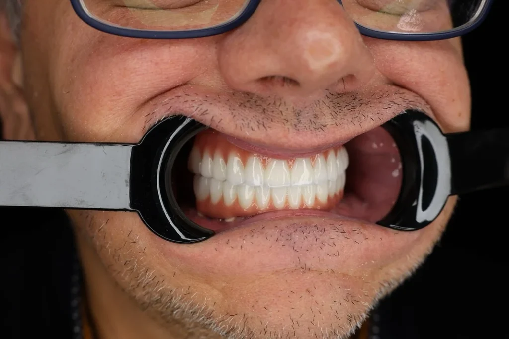 dentale albania1 Dental Tourism Albania