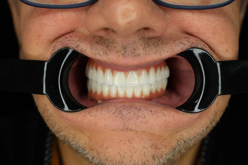 dentale albania2 Dental Tourism Albania