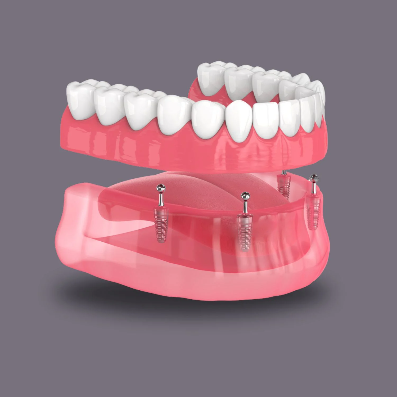 Dentures