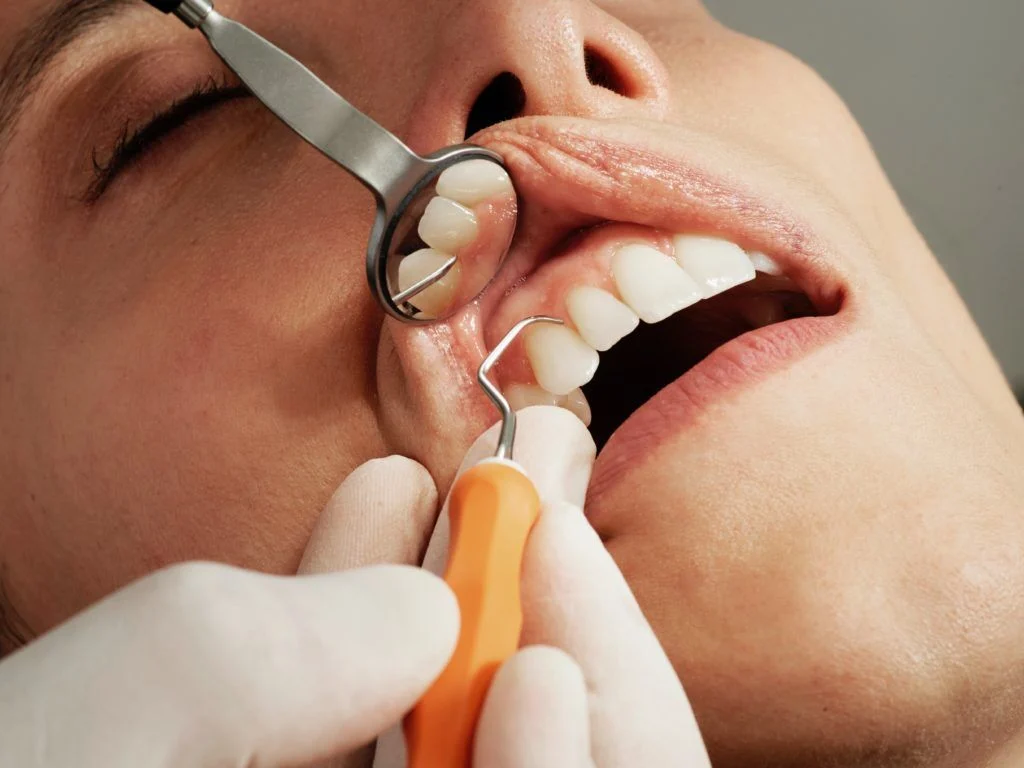 Gum Disease Treatment1