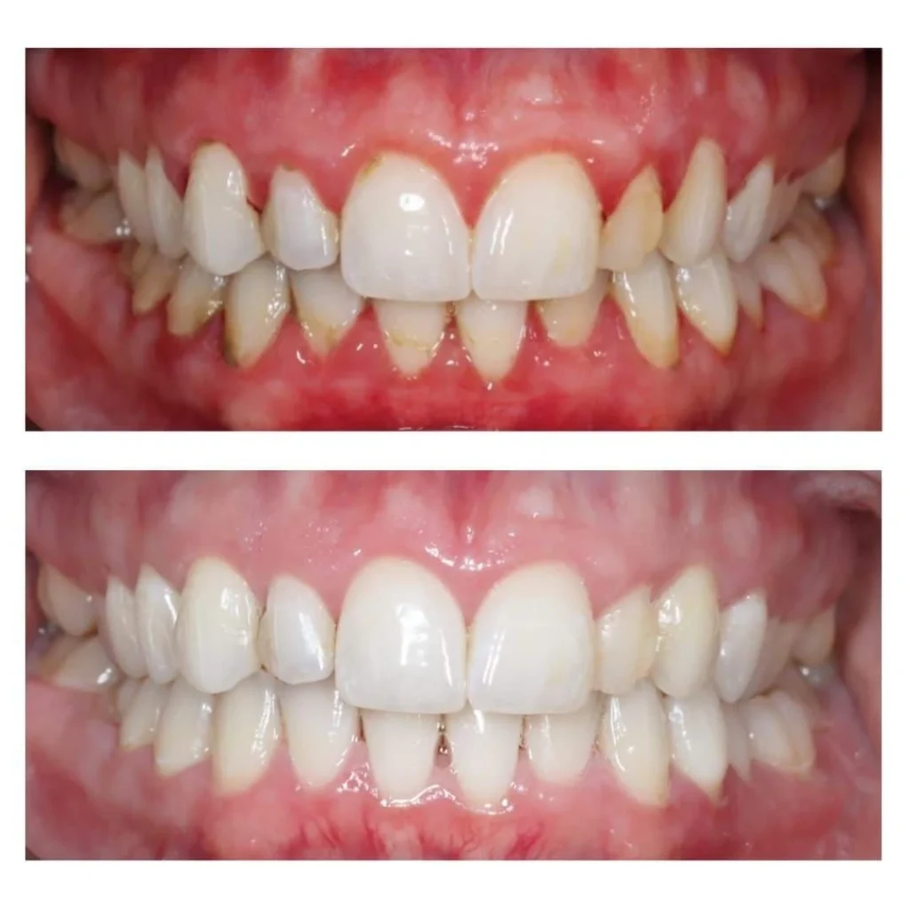 HEALTHY GUMS