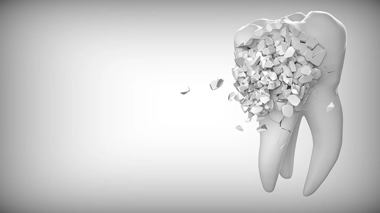 Trauma dentale2