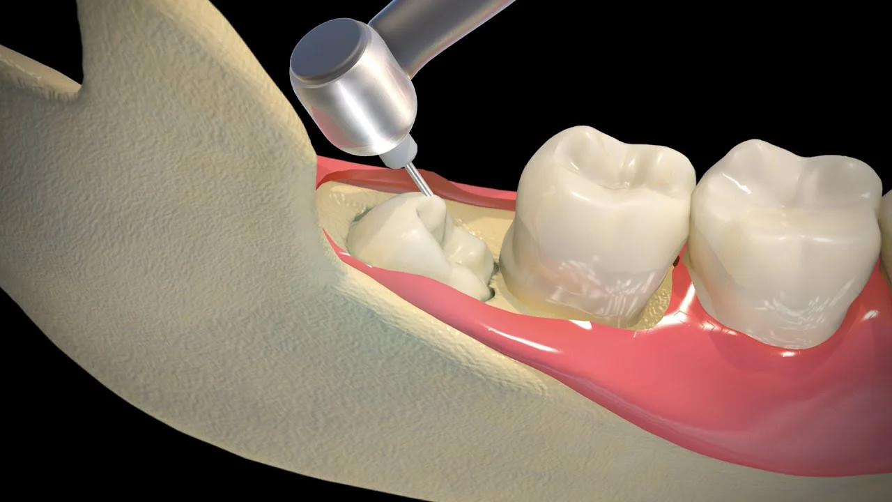Wisdom Extraction