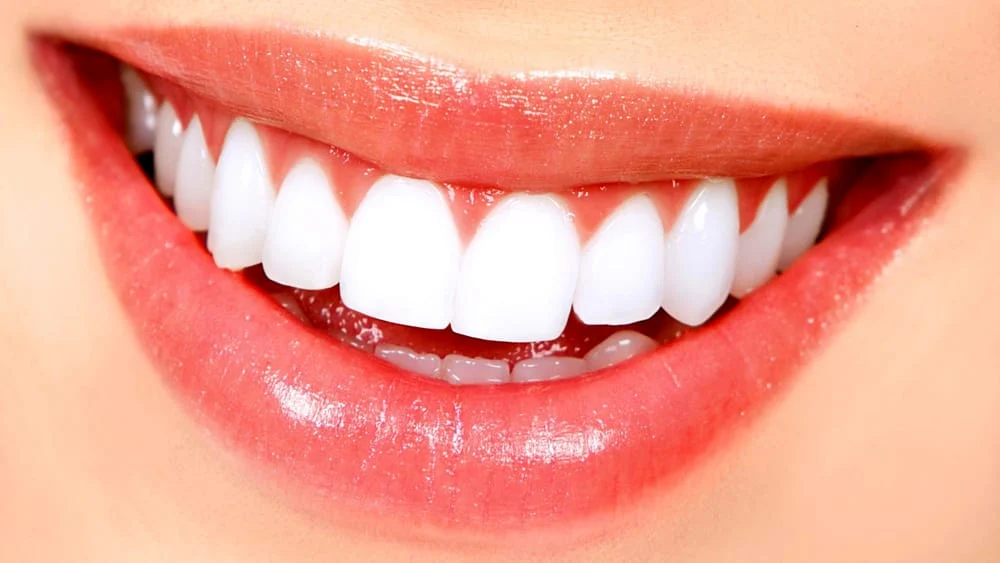 DENTI PERFETTI