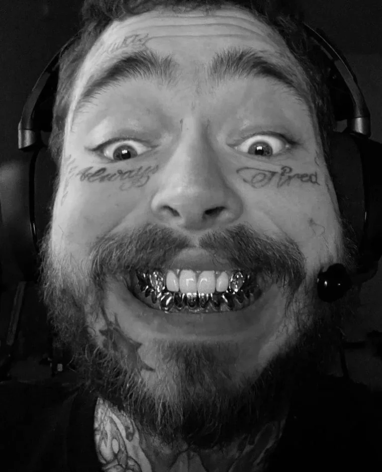 Post Malone Denti