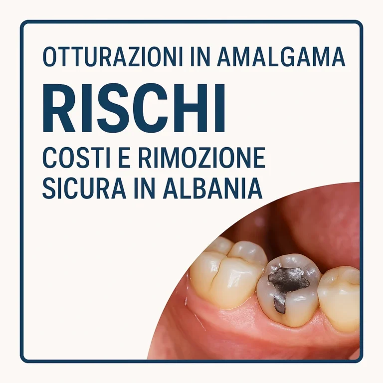 Otturazioni in amalgama