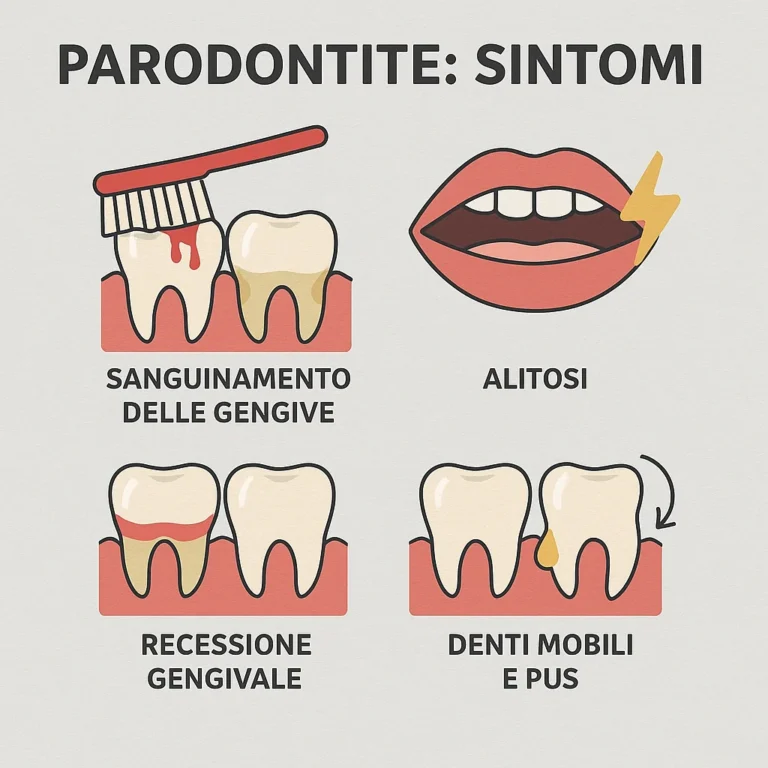 Parodontosi sintomi
