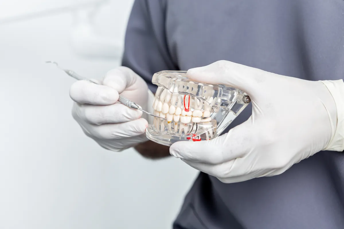 All on 4 Dental Implants in Albania