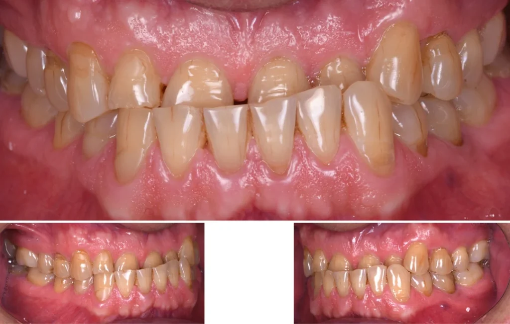 réhabilitation orale