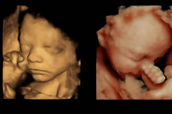 3D Scans