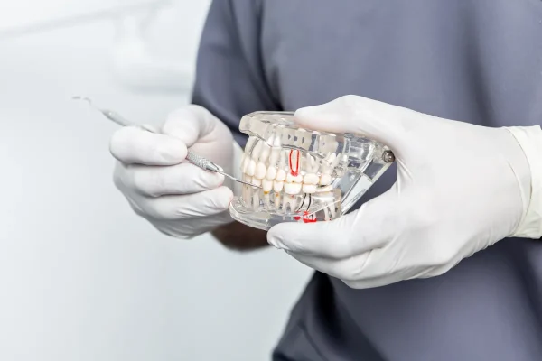 All on 4 Dental Implants in Albania