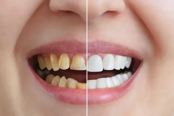 Cosmetic Dentistry Dental