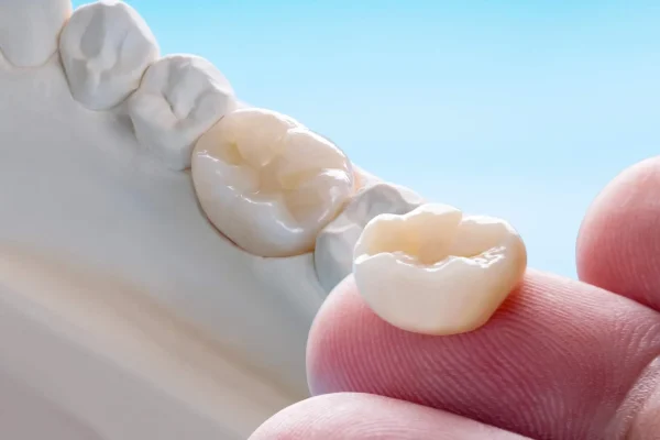 Crowns Kurorat dentare