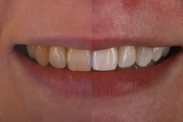 HEALTH TEETH