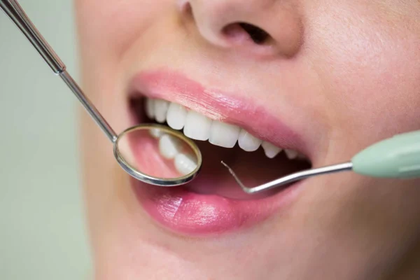 Pulizia dentale1