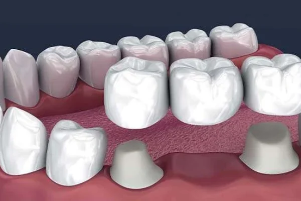 URAT DENTARE2
