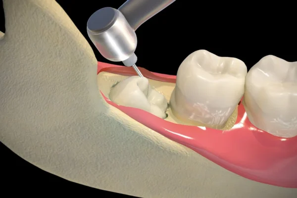 Wisdom Extraction