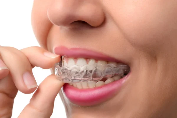 clear teeth braces1